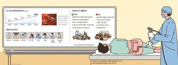 젊은 층에서 빠르게 늘고 있는 대장암은 정기적인 대장 내시경 검사가 가장 효과적인 예방법이다.