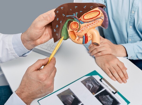 담낭암의 대표 위험 인자는 담석증이지만 최근에는 비만과 지방간, 대사증후군도 주요 위험 요인으로 지목된다. [출처 Gettyimagesbank]
